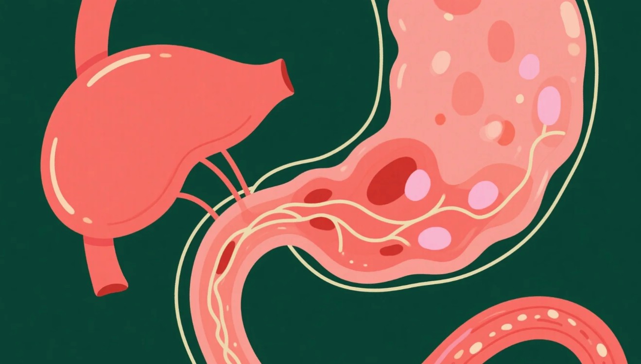 Atrofik Gastrit Nedir