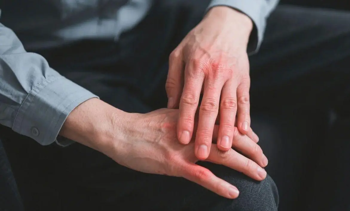 Romatoit Artrit Nedir? Belirtileri ve Tedavi Yöntemleri